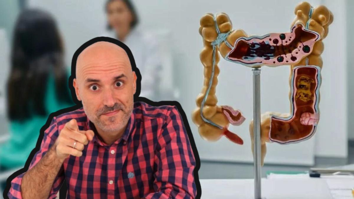 Fernando Fabiani, junto a la reproducción de un colon.