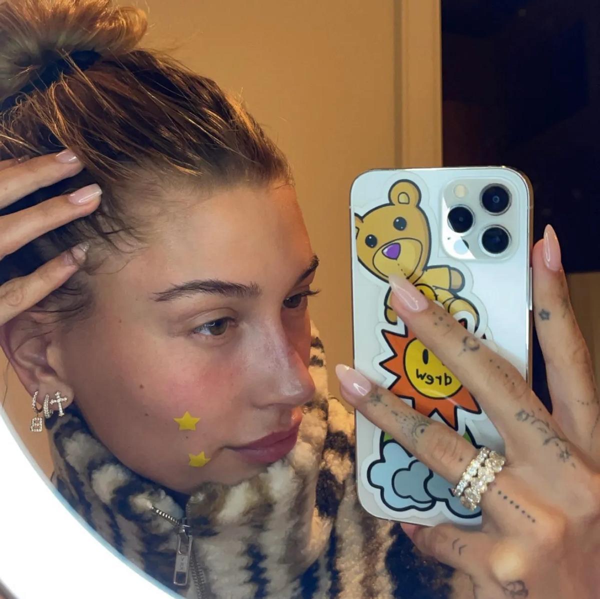 Hailey Bieber, avec les patchs anti-acné Starface.